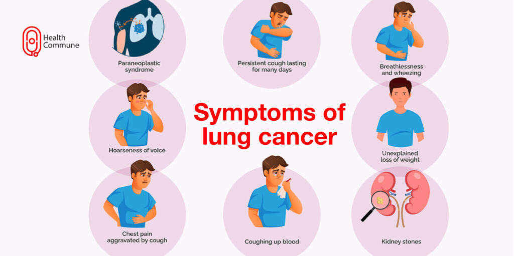 . Lung Cancer ()