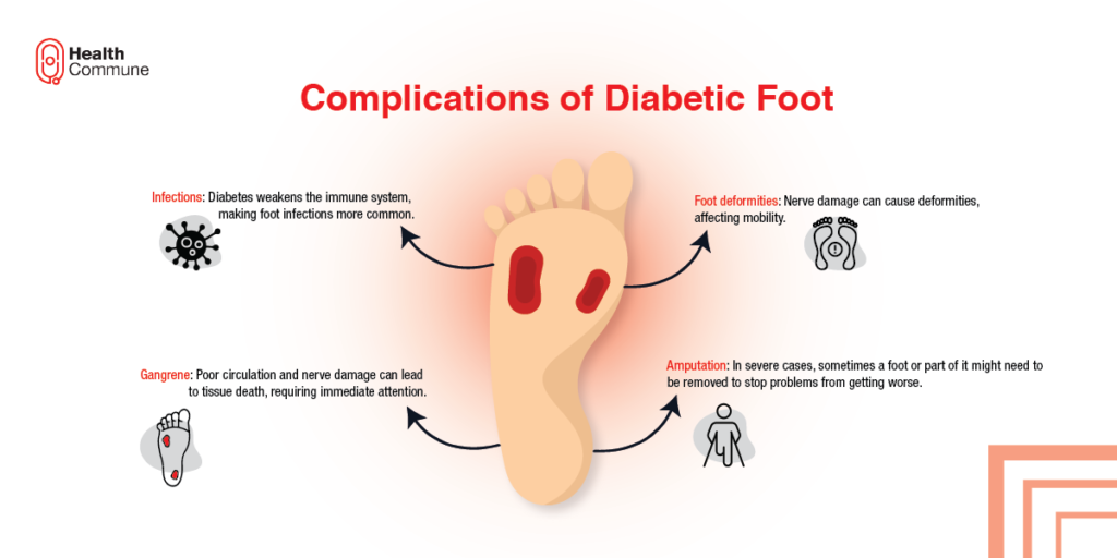Complications of diabetic foot