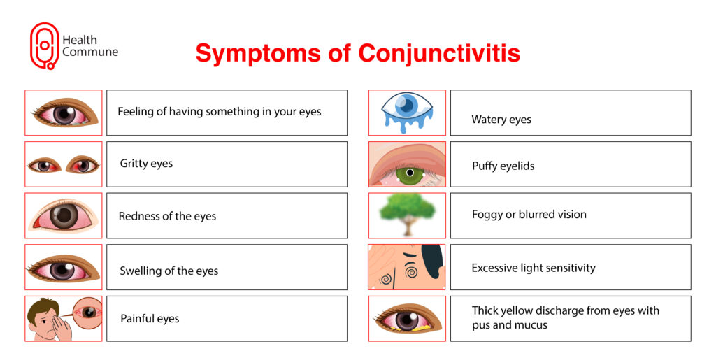 Conjuctivitis